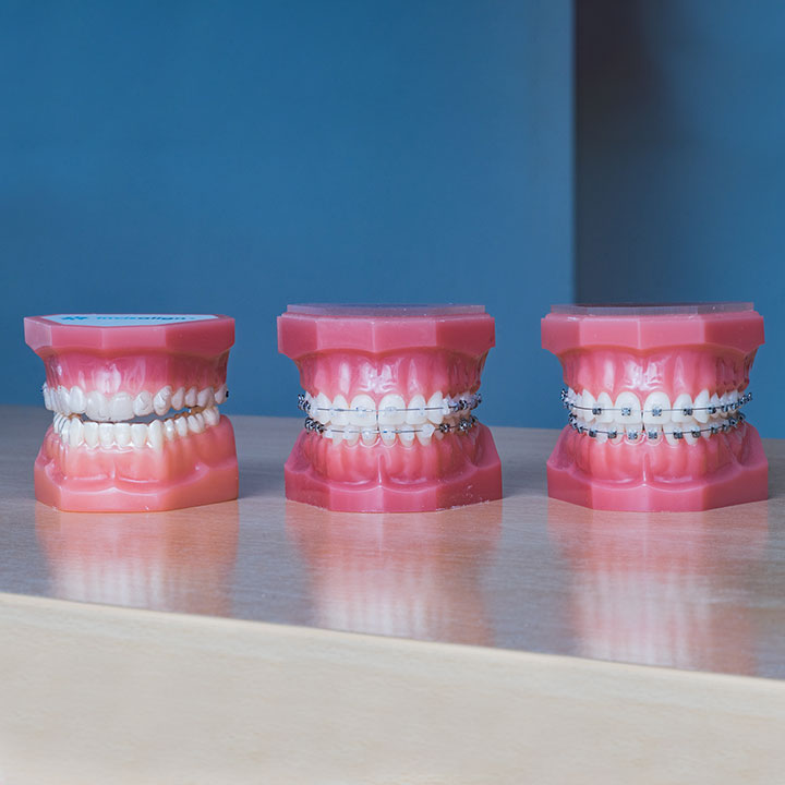 What is orthodontics